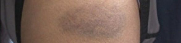 Quase mil agressões contra os mais velhos são registradas em Salvador