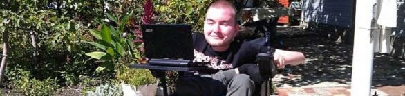 Doente terminal pode ser o 1º a fazer transplante de cabeça