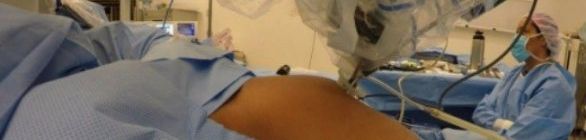 Brasil testa robô para remover câncer de útero com incisão única