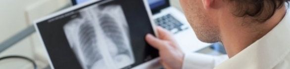 Salvador tem incidência de tuberculose acima da média nacional