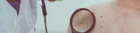 Cuidados na proteção da pele podem ajudar na prevenção do câncer de pele