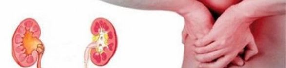 Mais de 120 mil pessoas tem doença renal crônica no Brasil