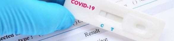 50 mil testes rápidos são adquiridos para detecção da Covid
