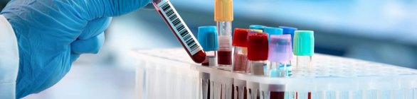 A influência do tipo sanguíneo na gravidade da Covid-19