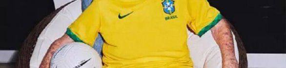 Zagallo tem melhora clínica e faz fisioterapia respiratória e motora