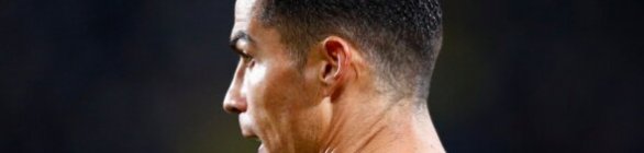 Cristiano Ronaldo treina de olho roxo com seleção de Portugal