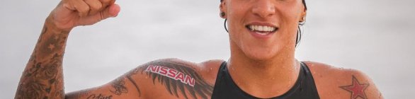 Ana Marcela Cunha passa por cirurgia no ombro: