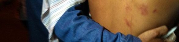 Mulher diz que foi chutada por Souza, depois de ter sido derrubada no chão