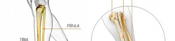 Anderson Silva é operado, passa bem e se desculpa pode 