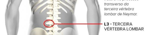 Infográfico: veja e entenda a fratura que tirou Neymar da Copa do Mundo