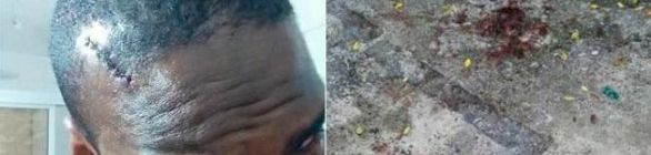 Jornalista denuncia agressão de policiais militares